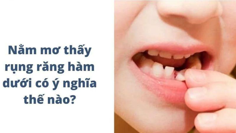 Bí Quyết Đánh Đề: Nằm Mơ Thấy Rụng Răng Hàm Dưới Trong Xổ Số Mang Đến May Mắn? 5 Nằm mơ thấy rụng răng hàm dưới có ý nghĩa như thế nào?