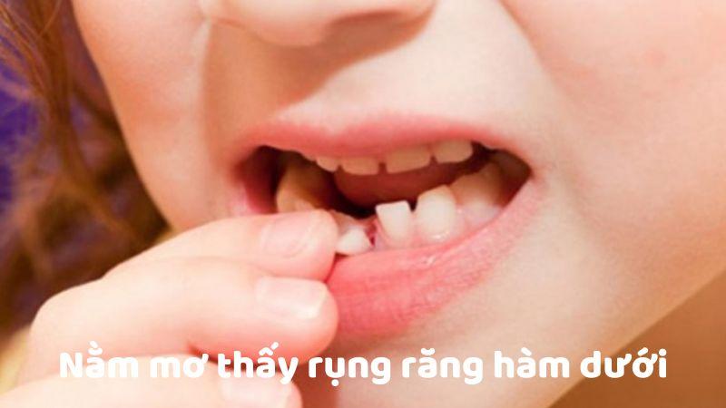 Bí Quyết Đánh Đề: Nằm Mơ Thấy Rụng Răng Hàm Dưới Trong Xổ Số Mang Đến May Mắn? 7 Bí quyết giải mã giấc mơ rụng răng hàm dưới