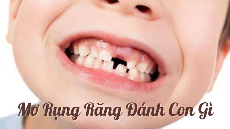 Nằm mơ thấy rụng răng đánh số mấy: Dự đoán số may mắn từ giấc mơ 6 Khi mơ thấy rụng răng người chơi số đã tìm ra con số may mắn cho mình