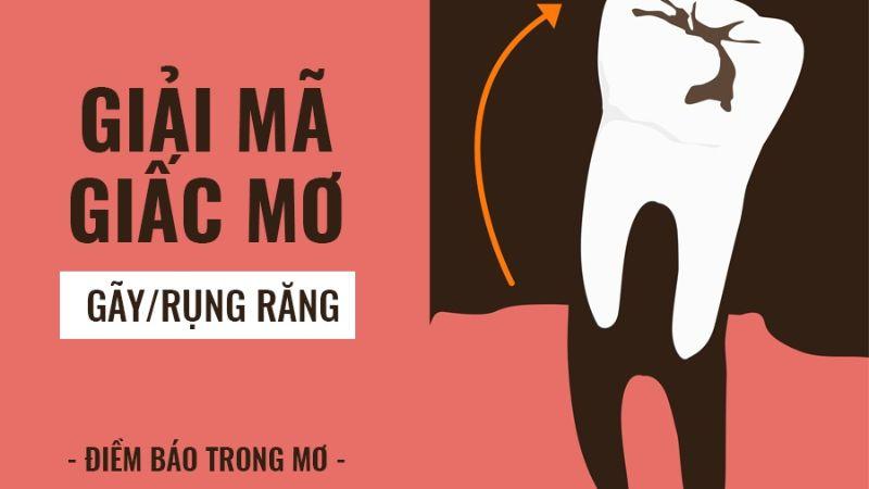 Nằm mơ thấy gãy răng trong lô đề: Đánh số may mắn cho chiến thắng 5 Giải mã giấc mơ khi nằm mơ thấy gẫy răng trong lô đề