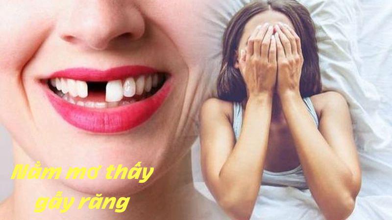 Nằm mơ thấy gãy răng trong lô đề: Đánh số may mắn cho chiến thắng 6 Những quan tâm và niềm tin vào các con số trong giấc mơ bị gẫy răng